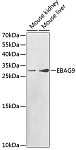 Western blot - EBAG9 Rabbit pAb (A1935)