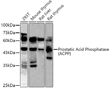 Prostatic Acid Phosphatase (ACPP) Rabbit polyclonal antibody