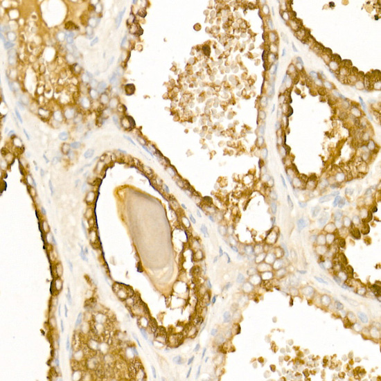 Prostatic Acid Phosphatase (ACPP) Rabbit polyclonal antibody
