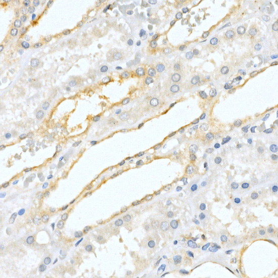 Prostatic Acid Phosphatase (ACPP) Rabbit polyclonal antibody