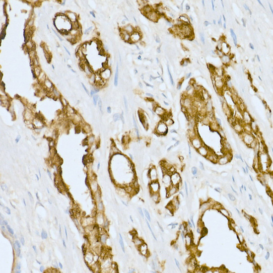 Prostatic Acid Phosphatase (ACPP) Rabbit polyclonal antibody