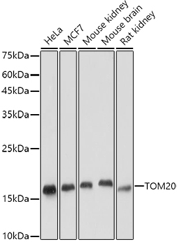 TOM20 Rabbit monoclonal antibody