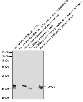 TOM20 Rabbit monoclonal antibody