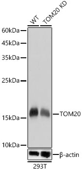 TOM20 Rabbit monoclonal antibody