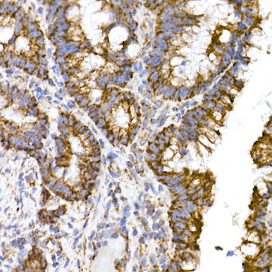 TOM20 Rabbit monoclonal antibody