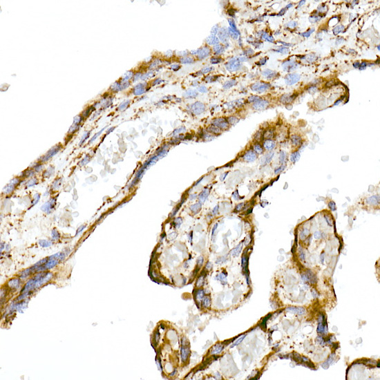 TOM20 Rabbit monoclonal antibody