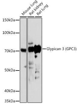 Glypican 3 (GPC3) Rabbit polyclonal antibody