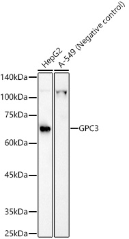 Glypican 3 (GPC3) Rabbit polyclonal antibody