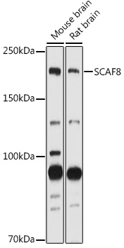 SCAF8 Rabbit polyclonal antibody