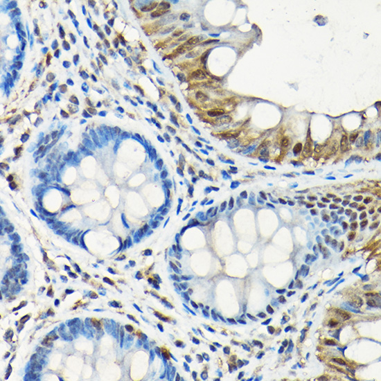 Smad5 Rabbit polyclonal antibody