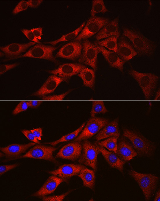 ODC1 Rabbit polyclonal antibody