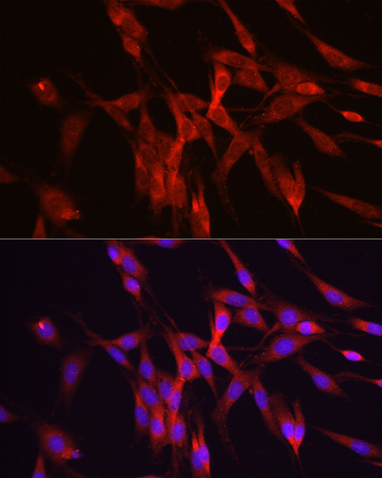 ODC1 Rabbit polyclonal antibody