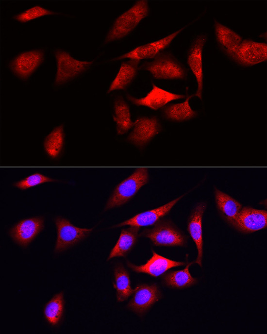 ODC1 Rabbit polyclonal antibody