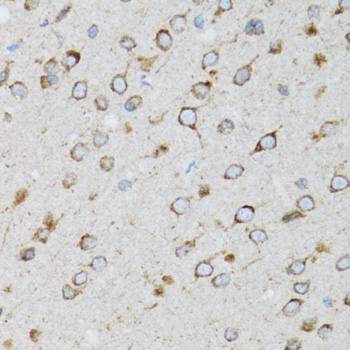 UBE2D1 Rabbit polyclonal antibody