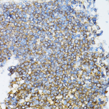 UBE2D1 Rabbit polyclonal antibody