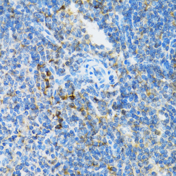 UBE2D1 Rabbit polyclonal antibody