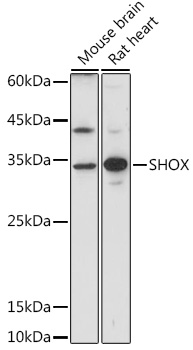 SHOX Rabbit polyclonal antibody