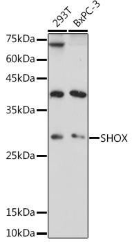 SHOX Rabbit polyclonal antibody