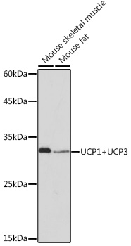 UCP1+UCP3 Rabbit monoclonal antibody