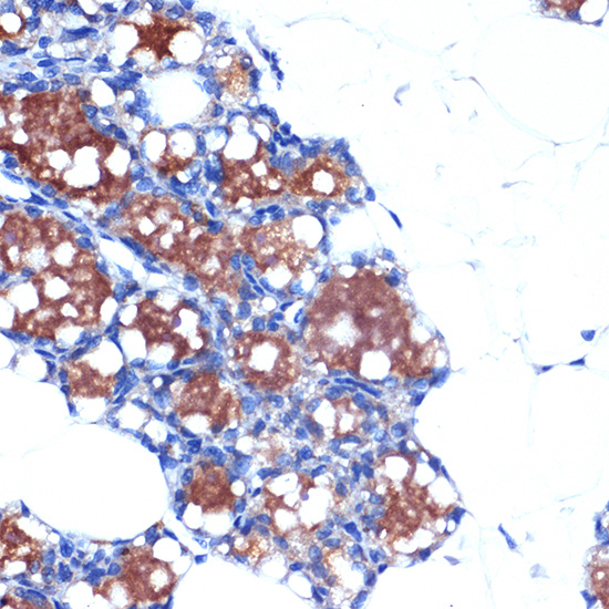 UCP1+UCP3 Rabbit monoclonal antibody