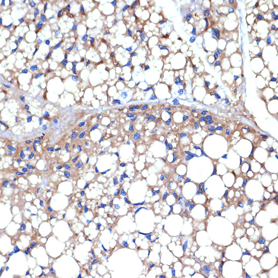 UCP1+UCP3 Rabbit monoclonal antibody