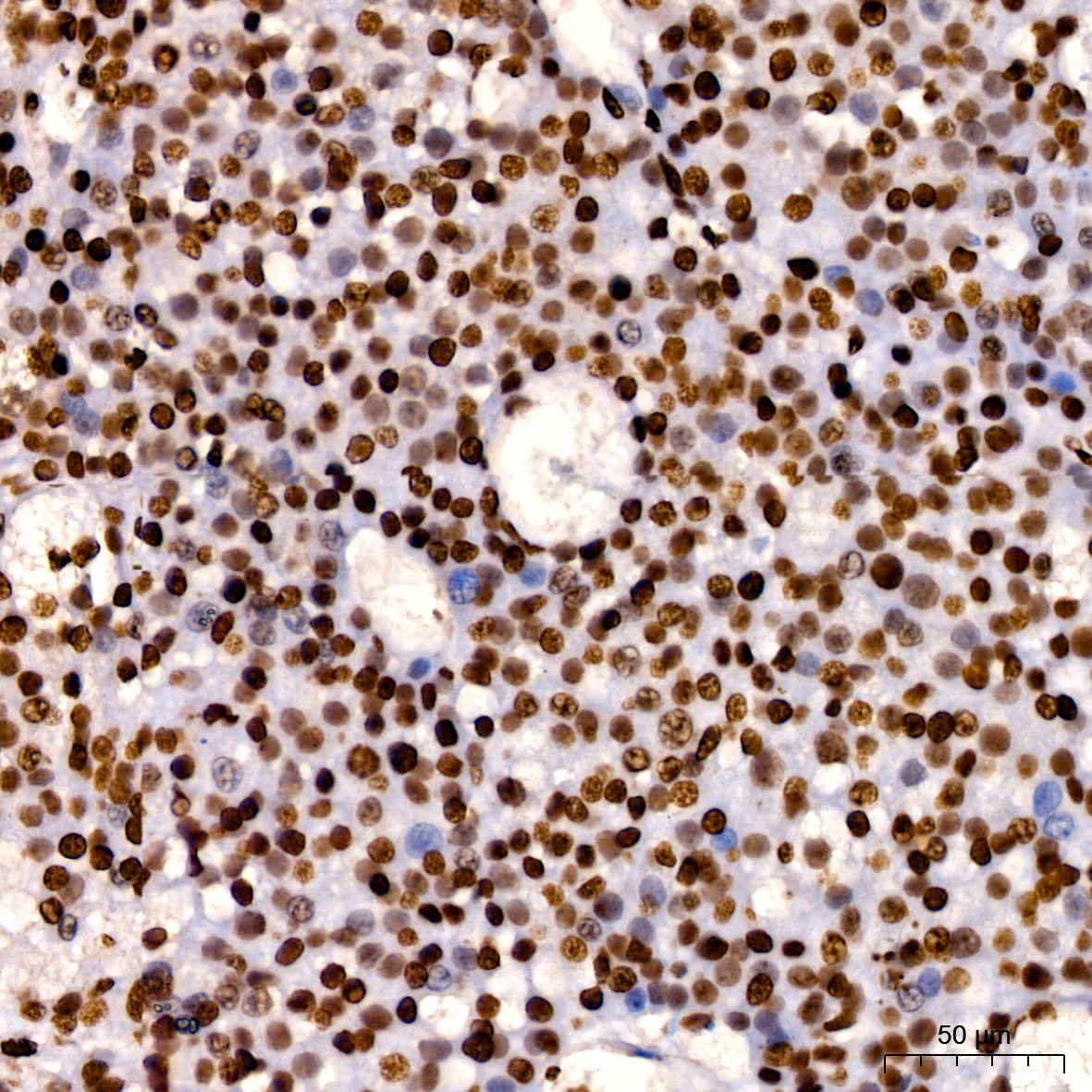 [KO Validated] HMGB1 Rabbit monoclonal antibody