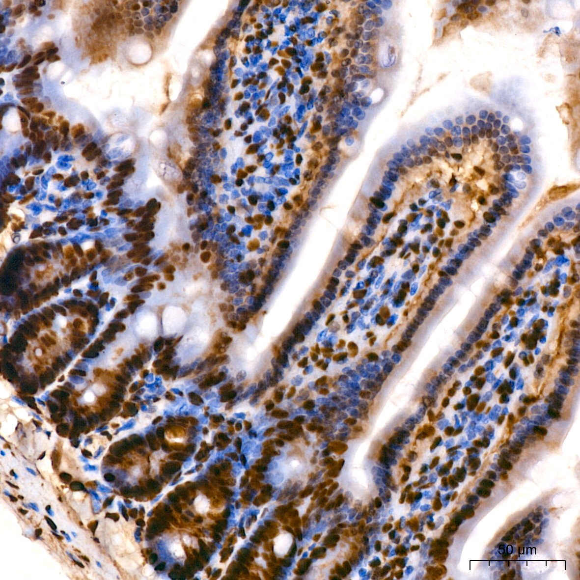 [KO Validated] HMGB1 Rabbit monoclonal antibody