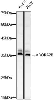 ADORA2B Rabbit polyclonal antibody