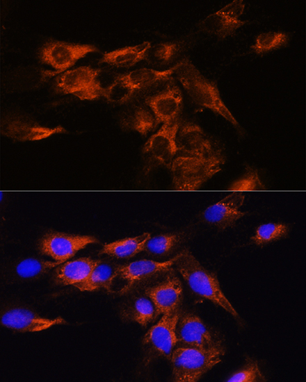 ADORA2B Rabbit polyclonal antibody