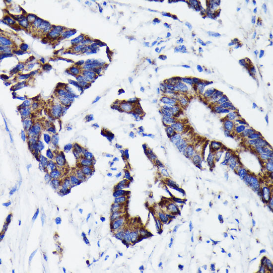 Prohibitin Rabbit monoclonal antibody