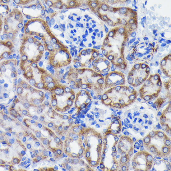 Prohibitin Rabbit monoclonal antibody