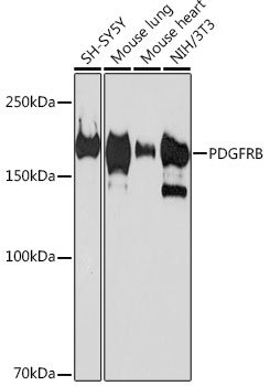 PDGFRB Rabbit monoclonal antibody