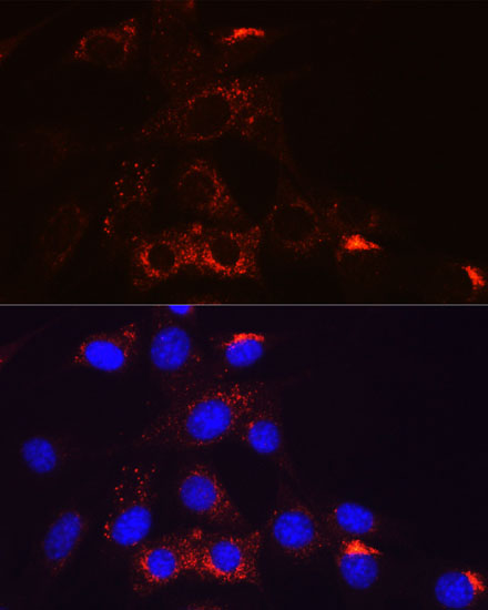 PDGFRB Rabbit monoclonal antibody