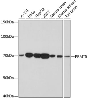 PRMT5 Rabbit monoclonal antibody