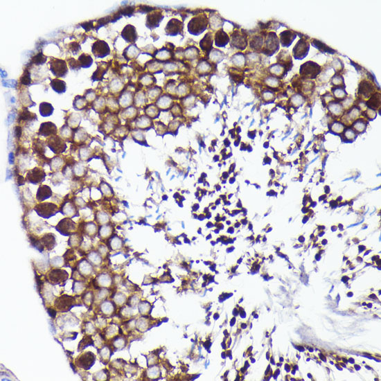 PRMT5 Rabbit monoclonal antibody