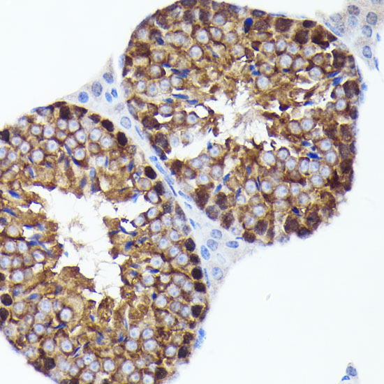 PRMT5 Rabbit monoclonal antibody