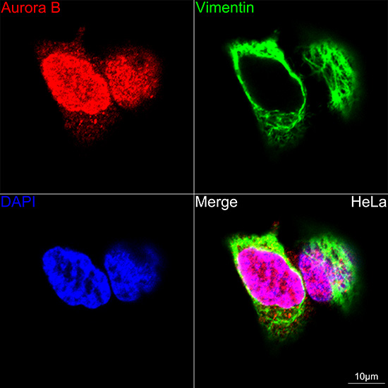 Aurora B Rabbit monoclonal antibody