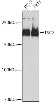 TSC2 Rabbit monoclonal antibody