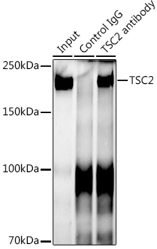 TSC2 Rabbit monoclonal antibody