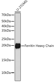 Ferritin Heavy Chain Rabbit monoclonal antibody