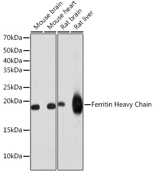 Ferritin Heavy Chain Rabbit monoclonal antibody