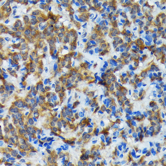 Thyroid Peroxidase Rabbit monoclonal antibody