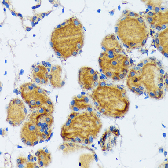 Thyroid Peroxidase Rabbit monoclonal antibody