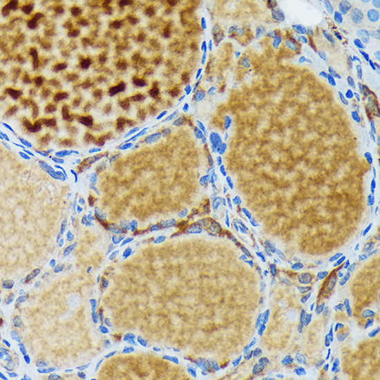 Thyroid Peroxidase Rabbit monoclonal antibody