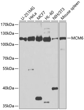 MCM6 Rabbit polyclonal antibody