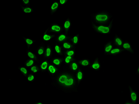 MCM6 Rabbit polyclonal antibody