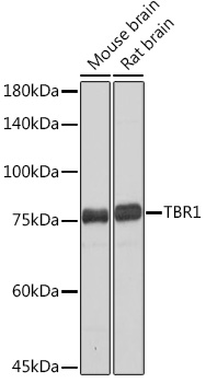 TBR1 Rabbit monoclonal antibody