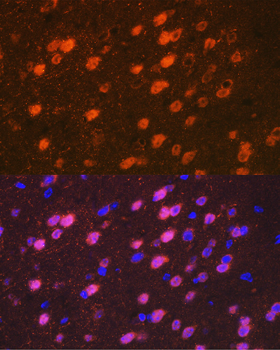 TBR1 Rabbit monoclonal antibody