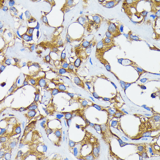 RARA Alpha Rabbit monoclonal antibody