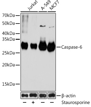 Caspase-6 Rabbit monoclonal antibody